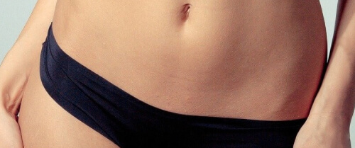 Labioplasti Ameliyatı Ankara